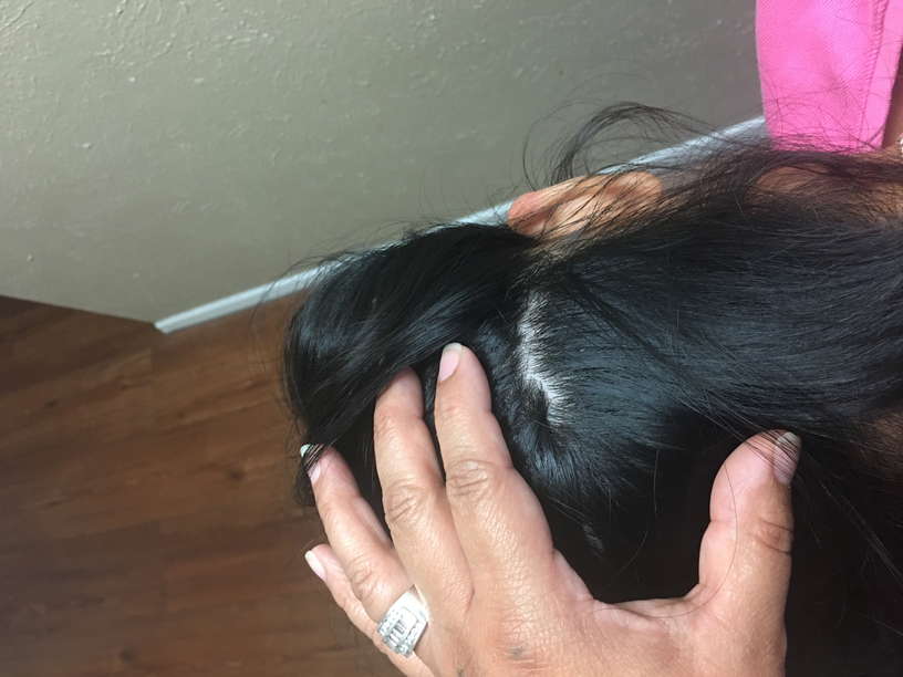 Hurst, Bedford, and Euless, Texas Lice Treatment & Lice Removal Service